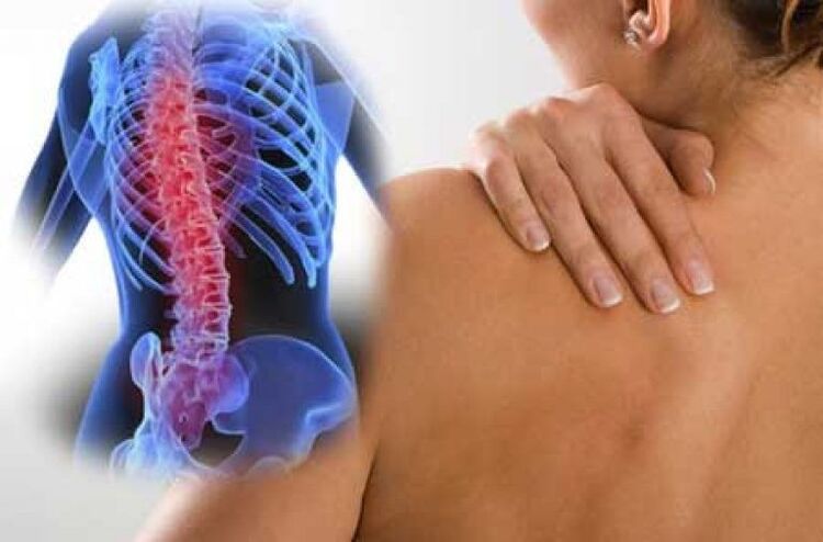 با پوکی استخوان، درد می‌تواند به قسمت‌های دوردست بدن سرایت کند