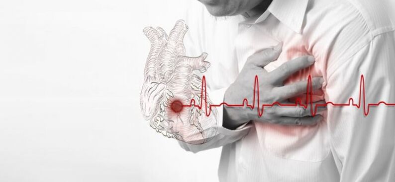حمله قلبی به عنوان علت درد زیر تیغه شانه چپ