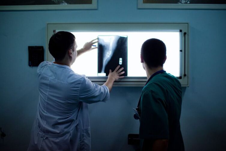 تشخیص آرتروز در X -ray
