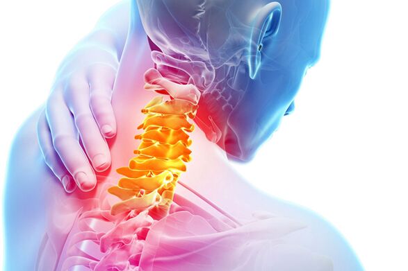 استئوکندروز گردن رحم