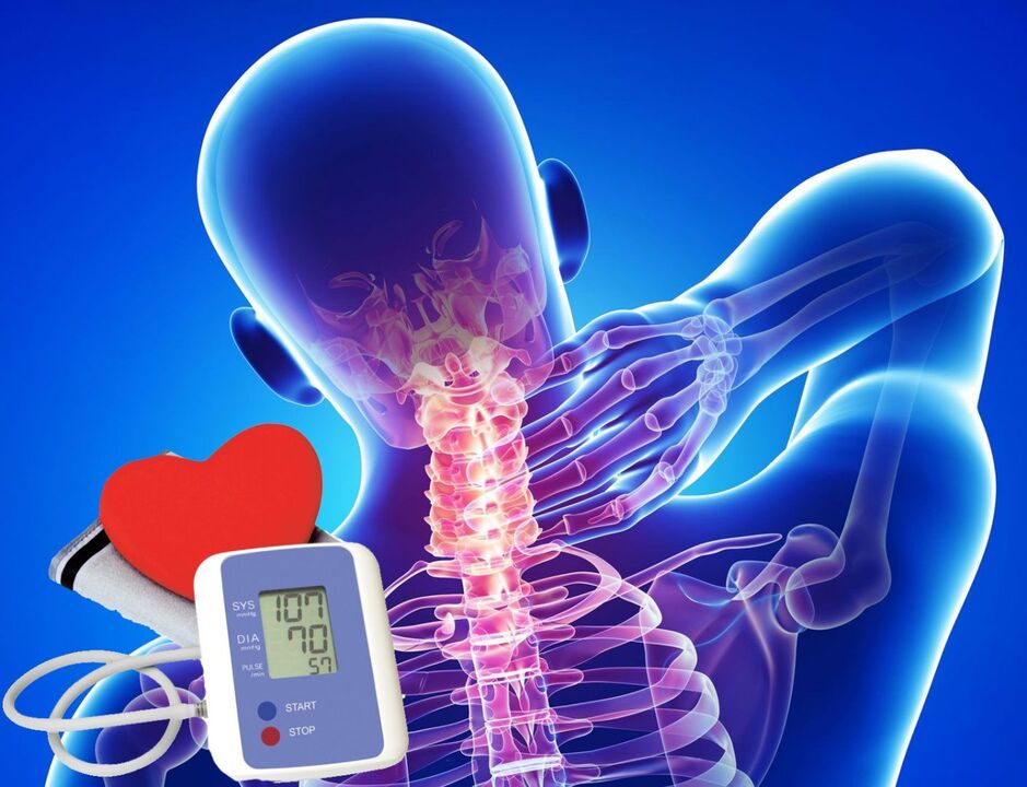 جهش فشار خون با استئوکندروز گردنی
